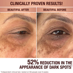 DARK SPOT CORRECTING RADIANCE RECOVERY SERUM - 10 ML
