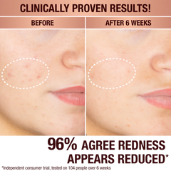 DARK SPOT CORRECTING PROTECT, HYDRATE & GLOW KIT - SKINCARE KIT